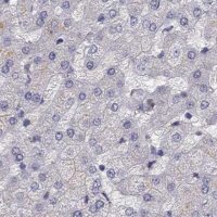 Anti-UHRF1 antibody produced in rabbit 