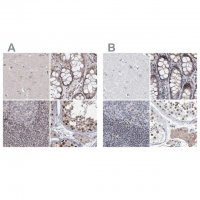 Anti-UIMC1 antibody produced in rabbit HPA037503-100UL