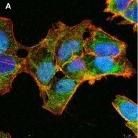 Anti-ULBP-3 Antibody, clone 3C10 ZooMAb� Rabbit Monoclonal 