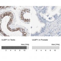 Anti-ULBP1 antibody produced in rabbit