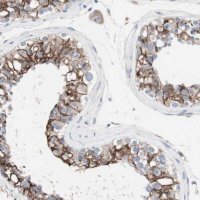 Anti-ULBP1 antibody produced in rabbit