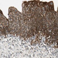 Anti-ULK2 antibody produced in rabbit