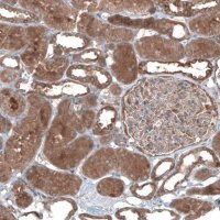 Anti-UMPS antibody produced in rabbit