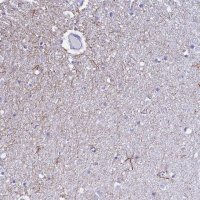 Anti-UNC80 antibody produced in rabbit