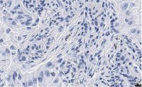 Anti-uPAR Antibody, clone 2G10 , ZooMAb� Rabbit Monoclonal 
