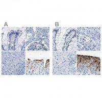 Anti-UPK3A antibody produced in rabbit 
