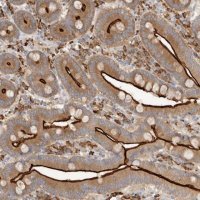 Anti-USH1C antibody produced in rabbit