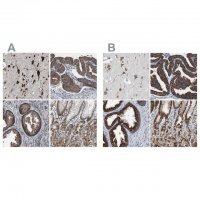 Anti-USP10 antibody produced in rabbit 