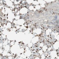 Anti-USP20 antibody produced in rabbit 