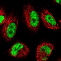 Anti-USP22 antibody produced in rabbit 