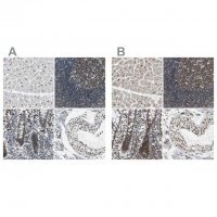 Anti-USP28 antibody produced in rabbit 