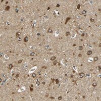 Anti-VAPB antibody produced in rabbit 