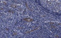 Anti-VCAM-1 Antibody, clone 5K19 ZooMAb� Rabbit Monoclonal 