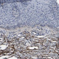 Anti-VCAN antibody produced in rabbit