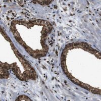 Anti-VCP antibody produced in rabbit 