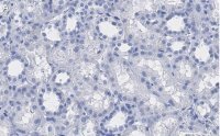 Anti-VDAC1 Antibody, clone 3M22, ZooMAb� Rabbit Monoclonal 