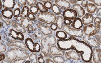 Anti-VDAC1 Antibody, clone 3M22, ZooMAb� Rabbit Monoclonal 