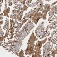 Anti-VEPH1 antibody produced in rabbit 
