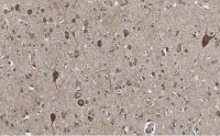 Anti-VGLUT2 Antibody, clone 8G9.2 ZooMAb� Mouse Monoclonal 