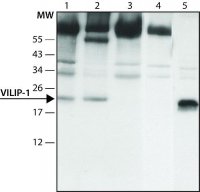 Anti-VILIP-1 (C-terminal) antibody produced in rabbit