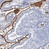 Anti-VILL antibody produced in rabbit 