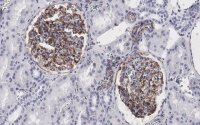 Anti-Vimentin Antibody, clone 2I13 ZooMAb� Rabbit Monoclonal 