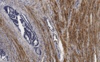 Anti-Vinculin Antibody, clone 3M13 ZooMAb� Rabbit Monoclonal 