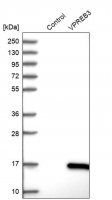 Anti-VPREB3 antibody produced in rabbit HPA003041-100UL