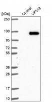 Anti-VPS18 antibody produced in rabbit 