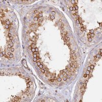 Anti-VPS18 antibody produced in rabbit 