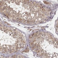 Anti-VPS26A antibody produced in rabbit HPA057498-100UL