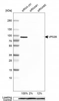 Anti-VPS35 antibody produced in rabbit HPA040802-100UL