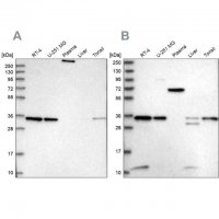 Anti-VPS37B antibody produced in rabbit HPA038218-100UL
