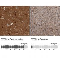 Anti-VPS53 antibody produced in rabbit 