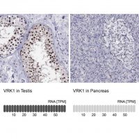 Anti-VRK1 antibody produced in rabbit 