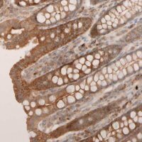Anti-VSTM2A antibody produced in rabbit 