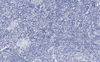 Anti-vWF Antibody, clone 1B21, ZooMAb� Rabbit Monoclonal 