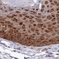 Anti-WAPL antibody produced in rabbit 