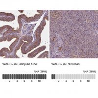 Anti-WARS2 antibody produced in rabbit 