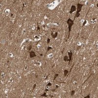 Anti-WASL antibody produced in rabbit 