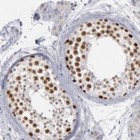 Anti-WDHD1 antibody produced in rabbit 