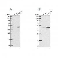 Anti-WDR18 antibody produced in rabbit HPA050193-100UL