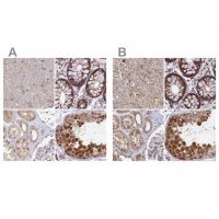 Anti-WDR61 antibody produced in rabbit 