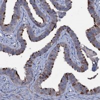 Anti-WDR66 antibody produced in rabbit