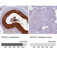 Anti-WFDC2 antibody produced in rabbit HPA042302-100UL