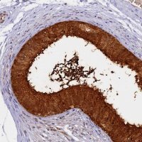 Anti-WFDC2 antibody produced in rabbit HPA042302-100UL