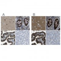 Anti-WNK2 antibody produced in rabbit 