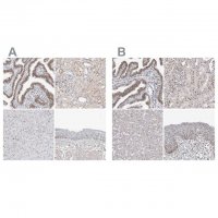 Anti-WRAP53 antibody produced in rabbit HPA023026-100UL