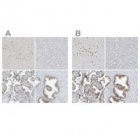 Anti-WRNIP1 antibody produced in rabbit 