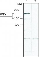 Anti-WTX (N-terminal) antibody produced in rabbit 